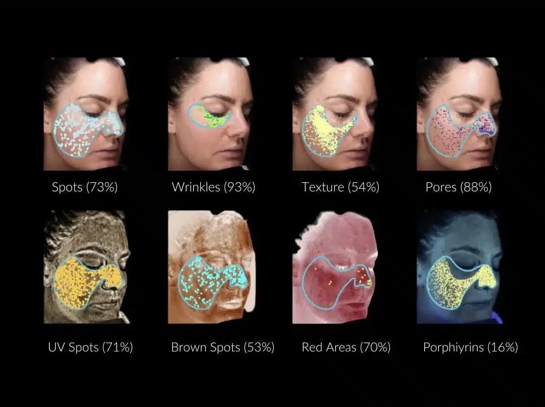 Analyse globale de la personne & Diagnostic Cutané par imagerie